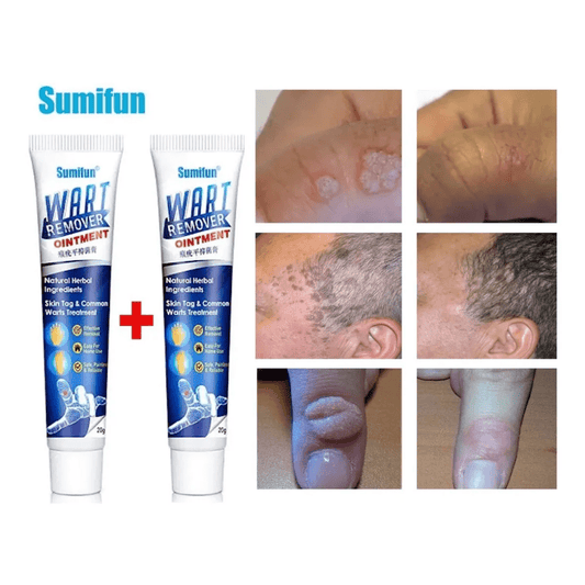 WART REMOVER - REMOVEDOR DE VERRUGA
